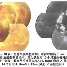 医疗利器 认识与使用敷贴器