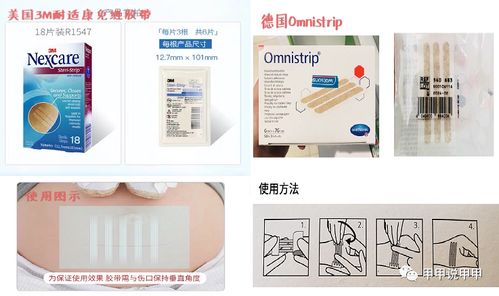 术后祛疤减张产品 减张器与减张贴相关问题汇总解答